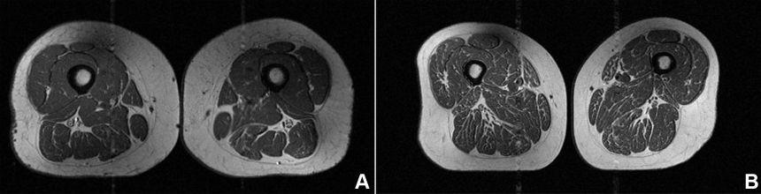The diet of the woman on the left was 29.5% ultra-processed, and the diet of the woman on the right was 87.1% ultra-processed.