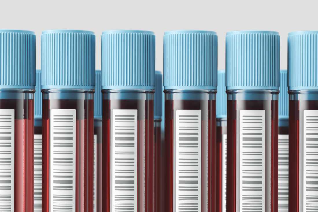 A vertical test tube containing blood with a blue lid, ready for testing. Medicine and science concept. 3D rendering